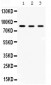 Anti-Aconitase 2 Picoband Antibody